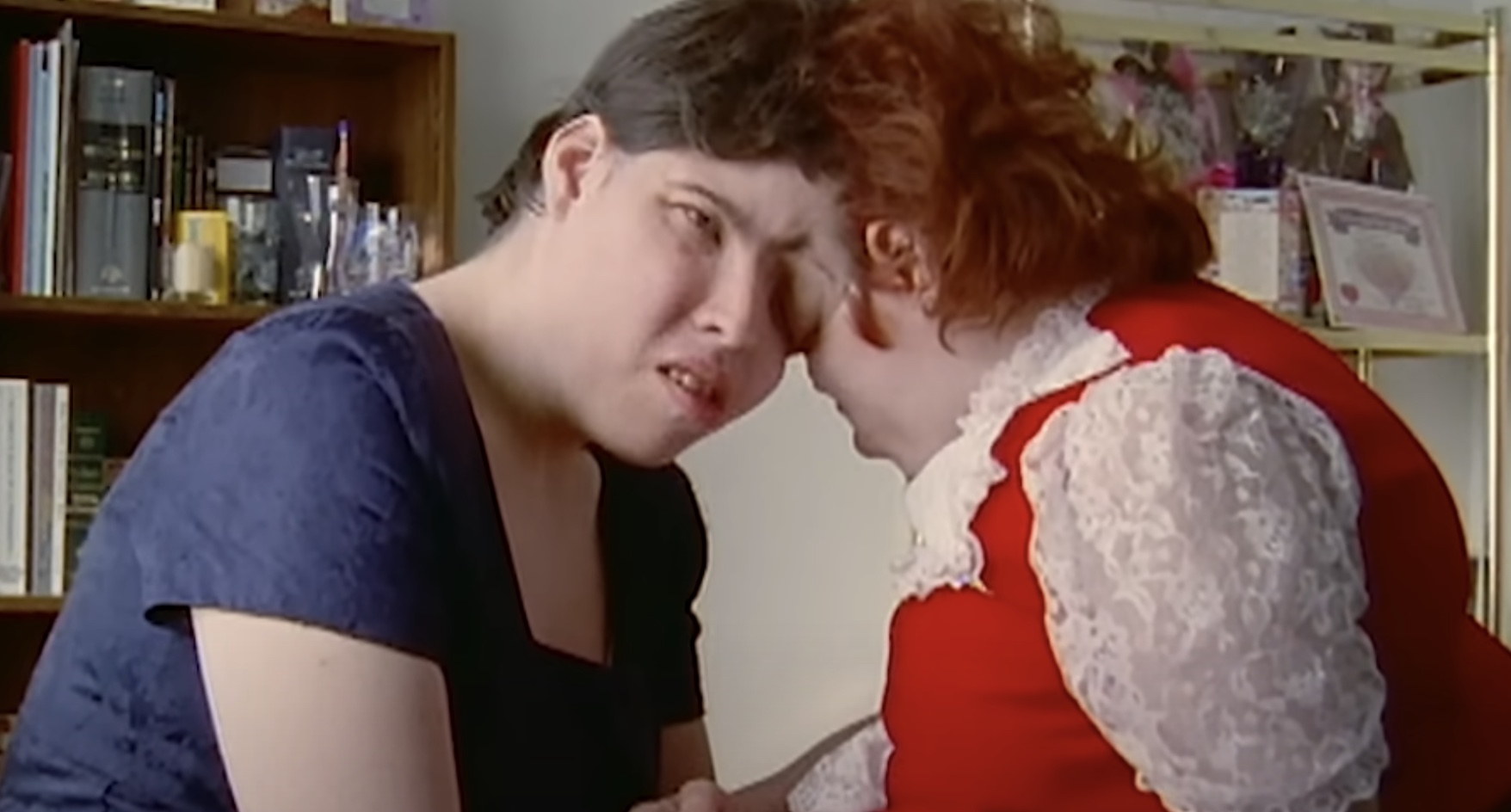 Les siamois Schappell sont décédés : l'un d'eux s'est révélé trans