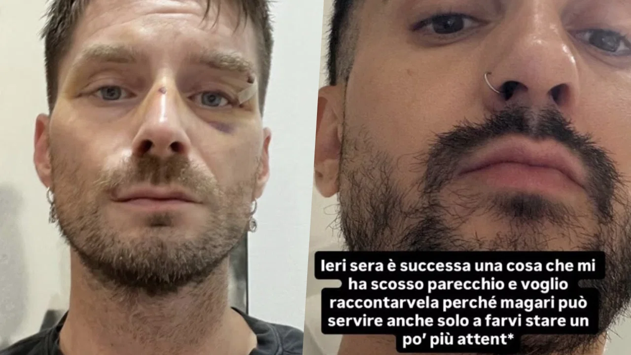 article-post